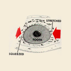 What is Orthodontics - After Braces Top View