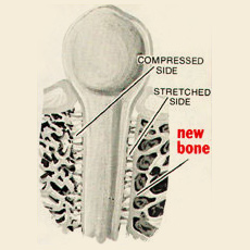 What is Orthodontics - New Bone